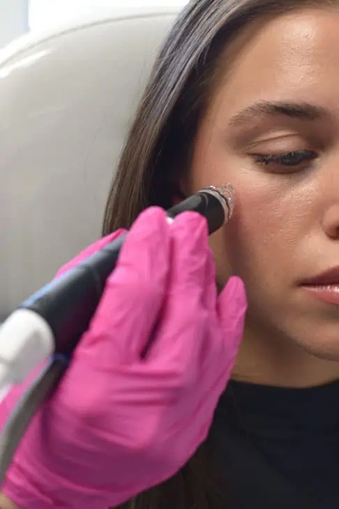Hydrafacial Delux