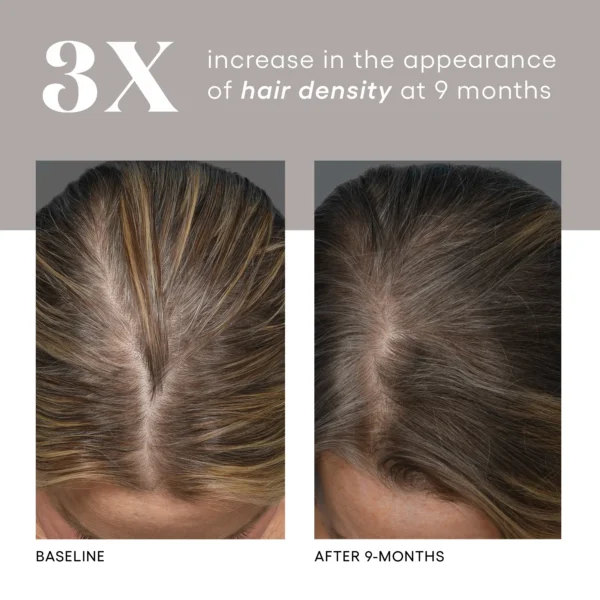 HAIR Serum - Image 6