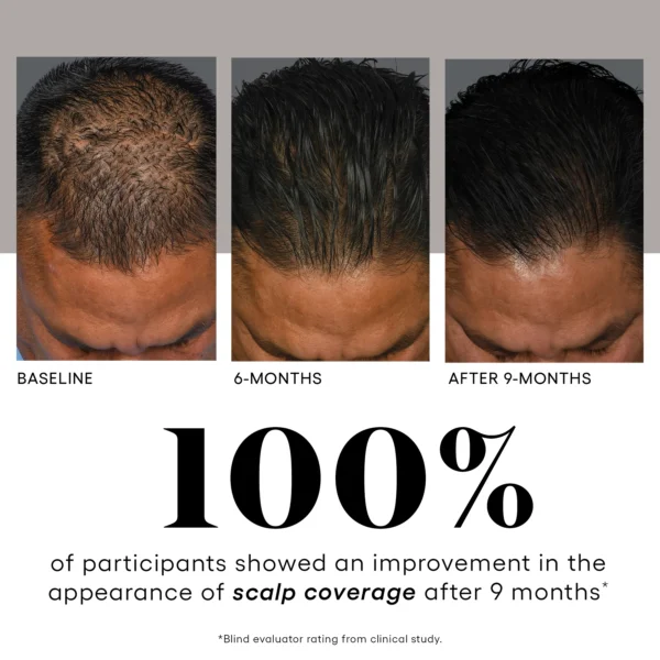 HAIR Serum - Image 7