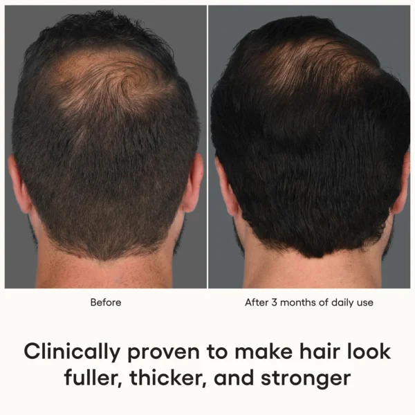 HAIR Serum - Image 2