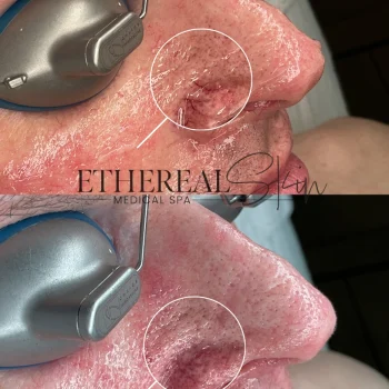 BBLMoxi B&A