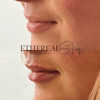 Lips B&A
