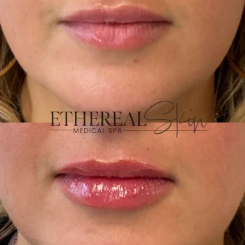 Lip 2 5.14