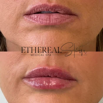 Lip 4 5.14
