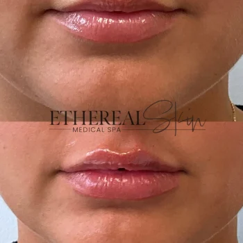 Lips B&A 3